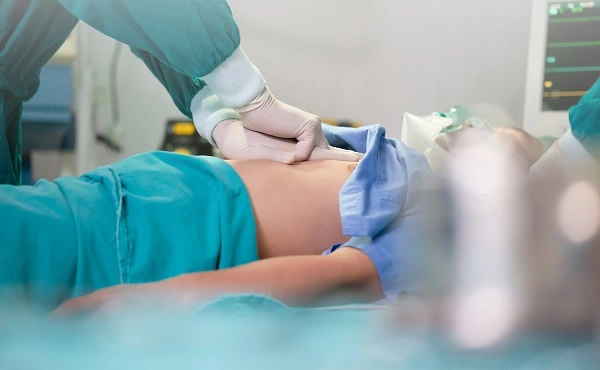 Image depicting a liposuction malpractice surgery in Turkey, showing a surgeon performing the procedure on a patient lying under anesthesia.